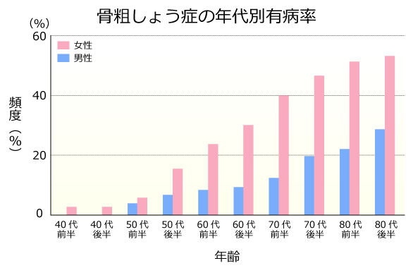 骨粗しょう症の年代別有病率