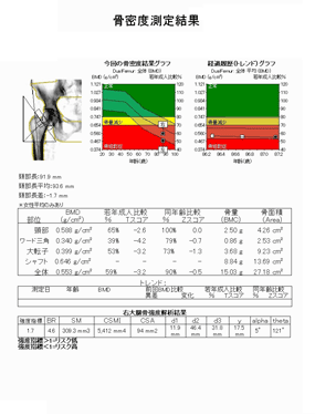 骨密度測定結果1